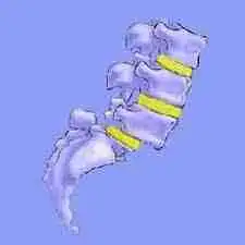 Sacroiliac Joint sease Sacroiliac Joint sease