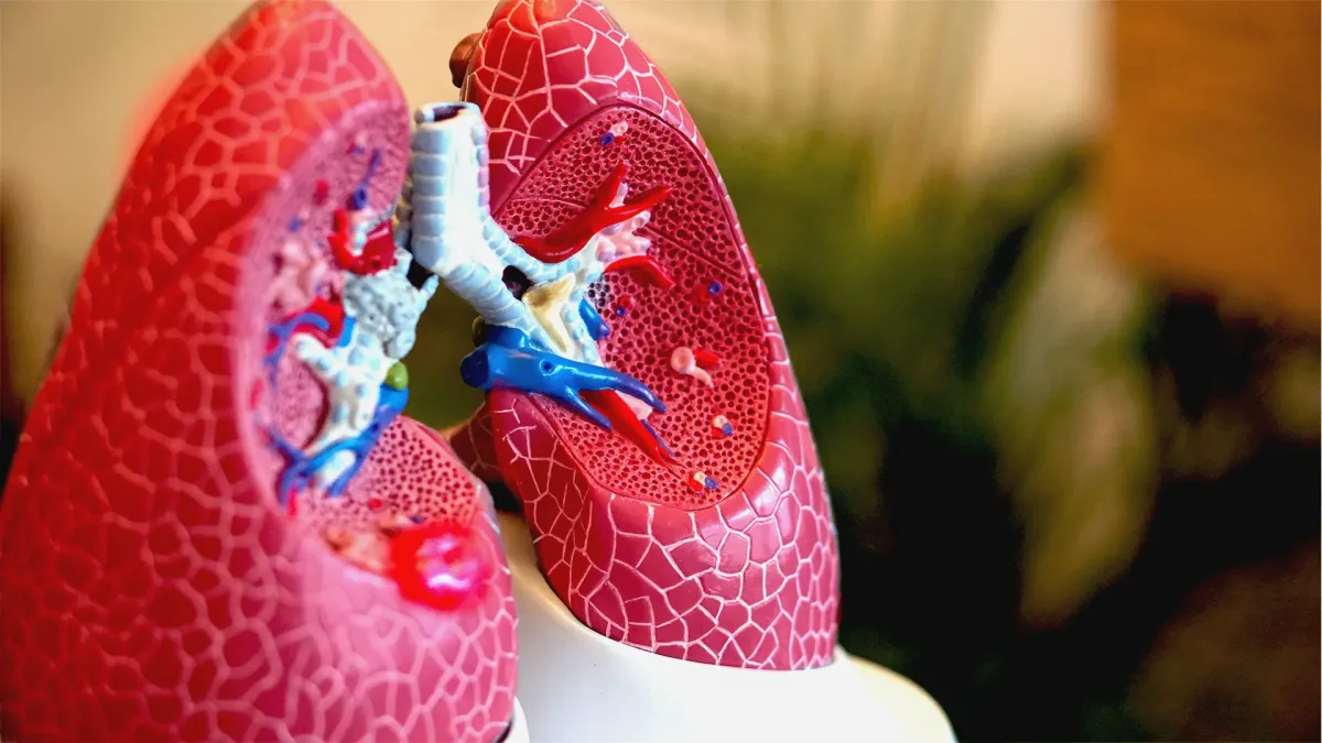 Lung Cancer