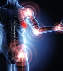 Herniated-Disc